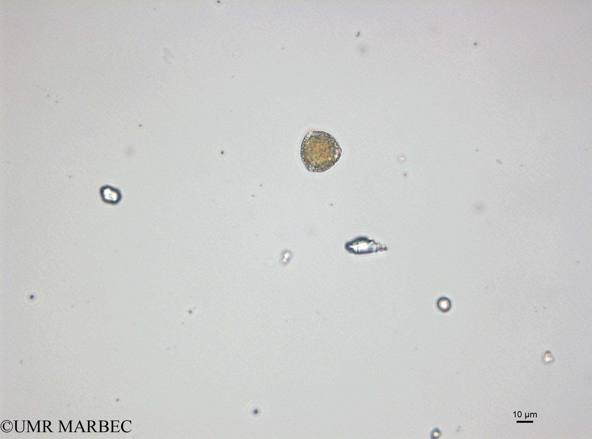 phyto/Bizerte/bizerte_bay/RISCO April 2014/Triceratium sp2 (141201_001_ovl-4)(copy).jpg